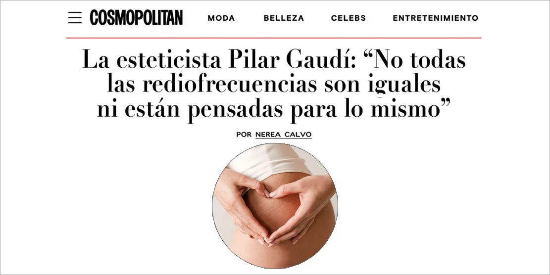 Cómo tratar la celulitis con radiofrecuencia | En Cosmopolitan