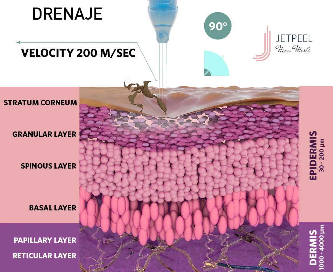 01-drenaje.webp