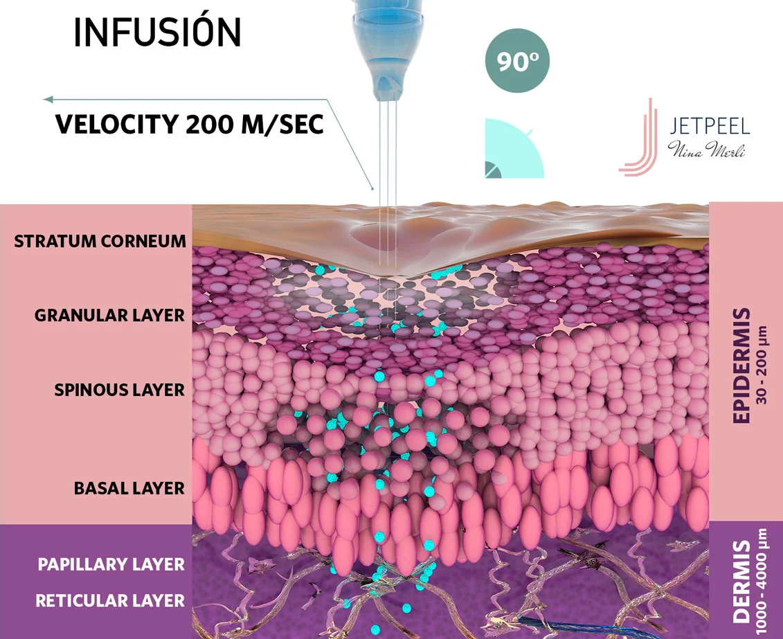 03-infusion.webp